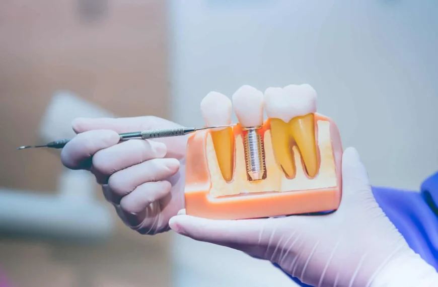 Regaining Confidence Through Advanced Dental Implant Treatments